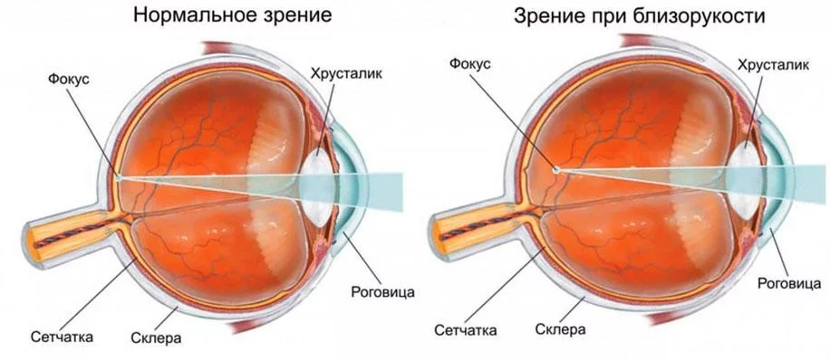 8d7d61d931671aebc7eeaab22e721ebb.jpg